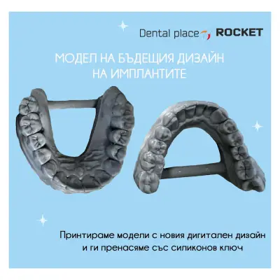 Стоматологичен кабинет Габрово “Rocket”/ Dental cabinet Gabrovo