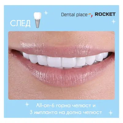 Стоматологичен кабинет Габрово “Rocket”/ Dental cabinet Gabrovo