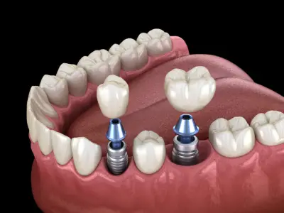 Dental clinic SA DENT