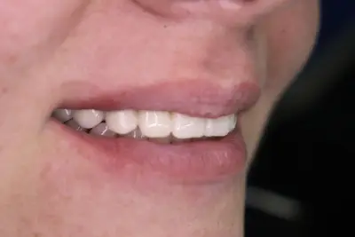Дентална имплантология "Д-р Георги Караангов"/ Dental Implantology 'Dr Georgi Karaangov'