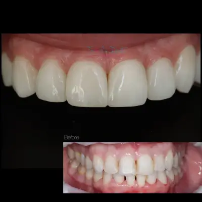 FAMILIA DENT VARNA Esthetics and Dental Tourism
