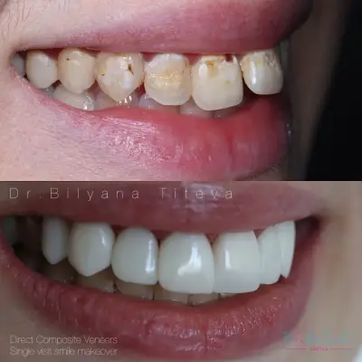 FAMILIA DENT VARNA Esthetics and Dental Tourism