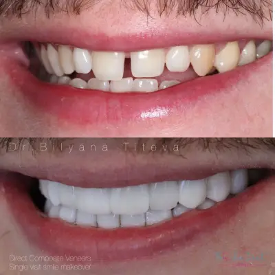 FAMILIA DENT VARNA Esthetics and Dental Tourism