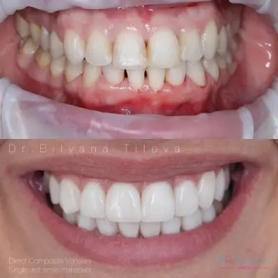 FAMILIA DENT VARNA Esthetics and Dental Tourism
