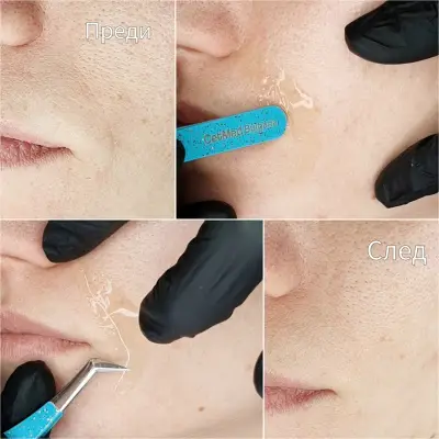 ЦитМед център Пловдив CetMed (микроблейдинг microblading)