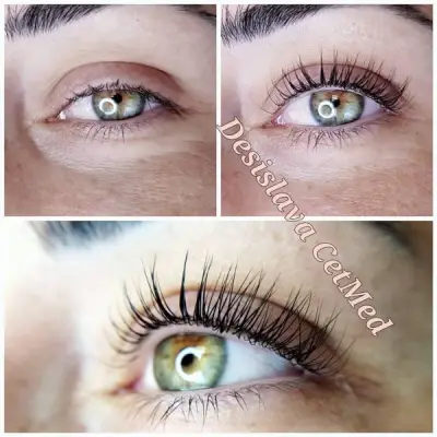 ЦитМед център Пловдив CetMed (микроблейдинг microblading)