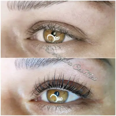 ЦитМед център Пловдив CetMed (микроблейдинг microblading)