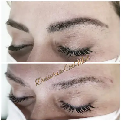 ЦитМед център Пловдив CetMed (микроблейдинг microblading)