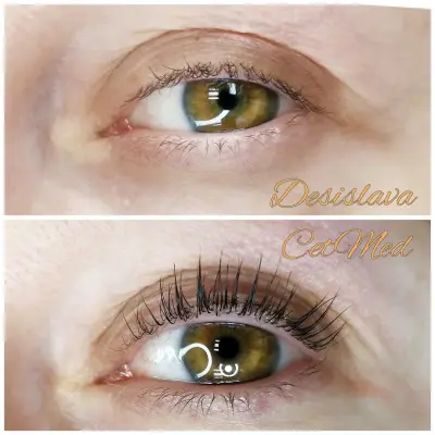 ЦитМед център Пловдив CetMed (микроблейдинг microblading)