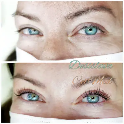 ЦитМед център Пловдив CetMed (микроблейдинг microblading)