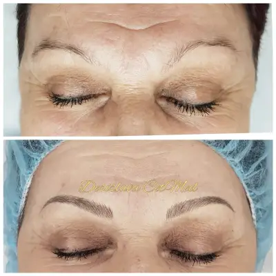 ЦитМед център Пловдив CetMed (микроблейдинг microblading)