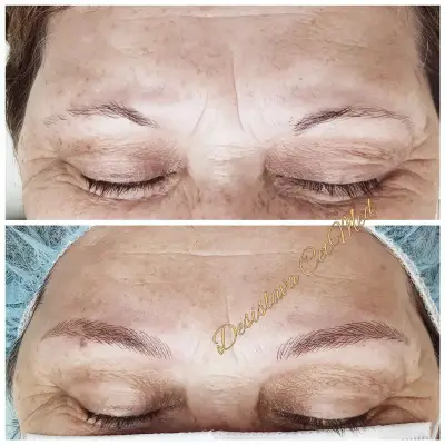 ЦитМед център Пловдив CetMed (микроблейдинг microblading)