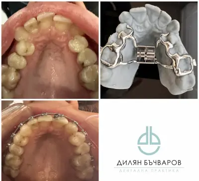 ДЕНТАЛНА КЛИНИКА БЪЧВАРОВ