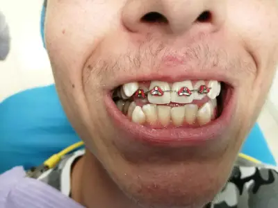 ASDent Dental Clinic | Детска стоматология и алайнери