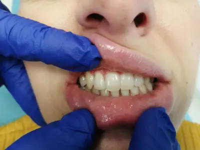 ASDent Dental Clinic | Детска стоматология и алайнери