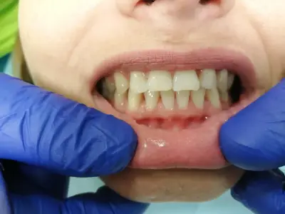 ASDent Dental Clinic | Детска стоматология и алайнери