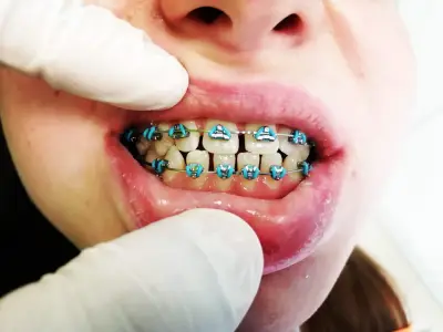 ASDent Dental Clinic | Детска стоматология и алайнери