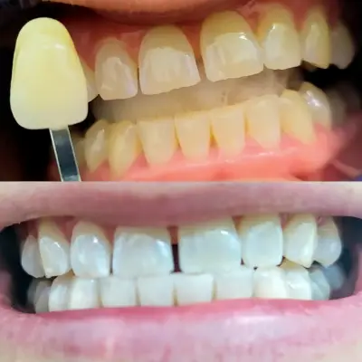 Зъболекар Пазарджик д-р Надежда Христова Dentist Dr. Nadezhda Hristova