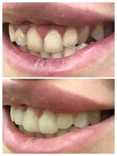 Зъболекар Пазарджик д-р Надежда Христова Dentist Dr. Nadezhda Hristova