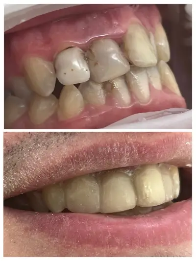Зъболекар Пазарджик д-р Надежда Христова Dentist Dr. Nadezhda Hristova