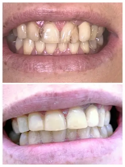 Зъболекар Пазарджик д-р Надежда Христова Dentist Dr. Nadezhda Hristova