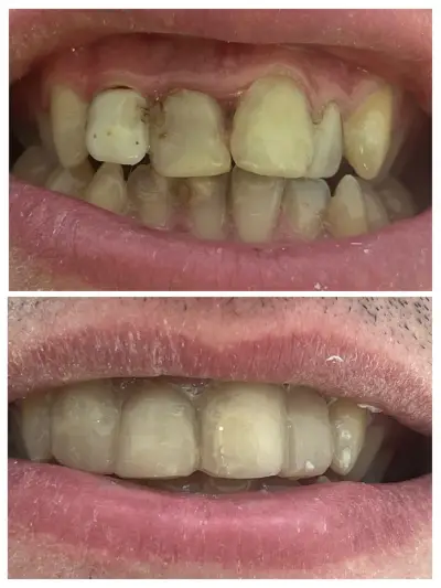 Зъболекар Пазарджик д-р Надежда Христова Dentist Dr. Nadezhda Hristova