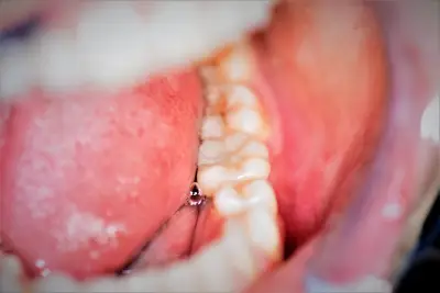 Дентален кабинет „Ивадент“ / Dental studio “Ivadent”