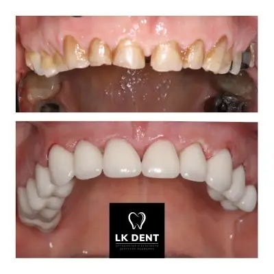 Дентална Клиника LK DENT - Ортодонтия, Естетика, Имплантология, Стоматолог