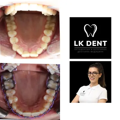 Дентална Клиника LK DENT - Ортодонтия, Естетика, Имплантология, Стоматолог