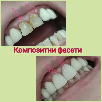 Зъболекар Пазарджик д-р Десислава Муртева Стоматолог