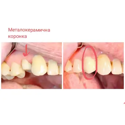 Зъболекар Пазарджик д-р Десислава Муртева Стоматолог