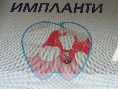 Зъболекарски кабинет G dent