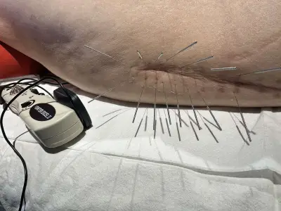 PhysioPro Bansko/ ФизиоПро Банско | Физиотерапия Банско | Лечебни масажи | Кинезитерапия | Остеопатия/Osteopathy
