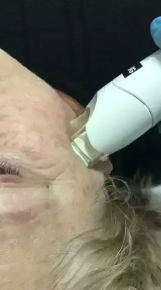 Лазерен център Конфидо