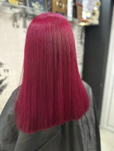 Scandall Beauty Studio І Ботокс І Подчертаване на скули І Запълване на бръчки І Корекция на носа