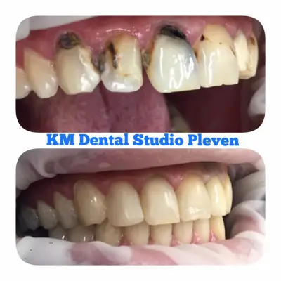 KM Dental Studio Pleven