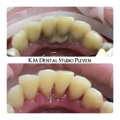KM Dental Studio Pleven