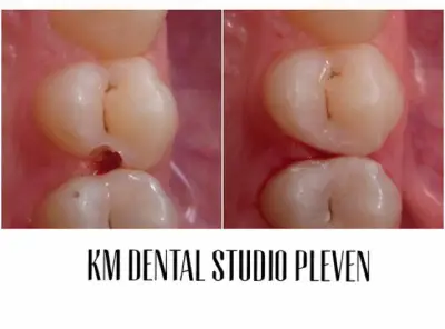 KM Dental Studio Pleven