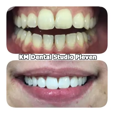 KM Dental Studio Pleven