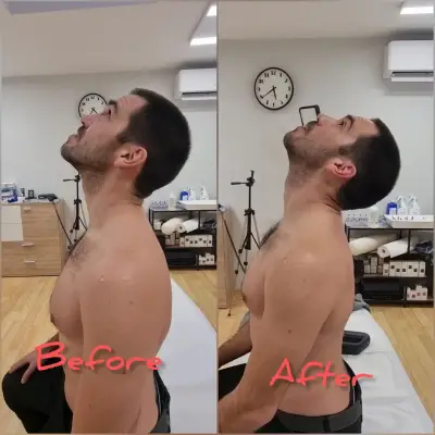 Kanchev7therapy