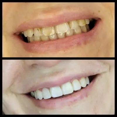 Smilehub Varna Dental Studio| Зъболекар Варна| д-р Йоанна Недялкова