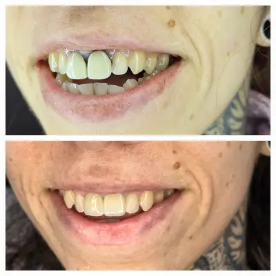 Smilehub Varna Dental Studio| Зъболекар Варна| д-р Йоанна Недялкова