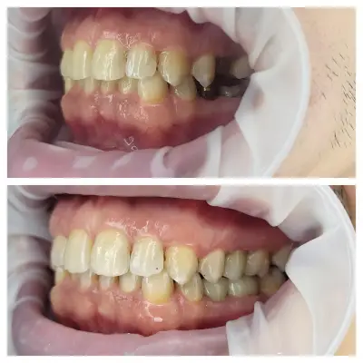 Smilehub Varna Dental Studio| Зъболекар Варна| д-р Йоанна Недялкова