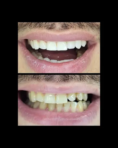 Smilehub Varna Dental Studio| Зъболекар Варна| д-р Йоанна Недялкова