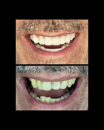 Smilehub Varna Dental Studio| Зъболекар Варна| д-р Йоанна Недялкова