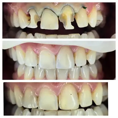 Smilehub Varna Dental Studio| Зъболекар Варна| д-р Йоанна Недялкова