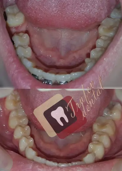 ТРУФЕВ ДЕНТАЛ (Trufev Dental) - Orthodontic and Complex Dental Solutions