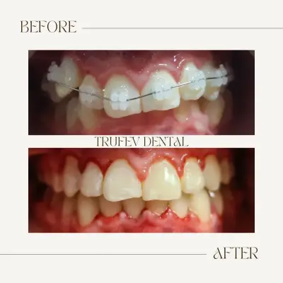 ТРУФЕВ ДЕНТАЛ (Trufev Dental) - Orthodontic and Complex Dental Solutions