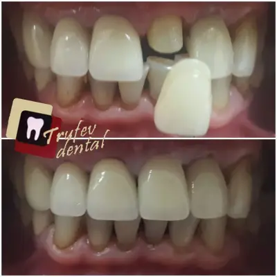ТРУФЕВ ДЕНТАЛ (Trufev Dental) - Orthodontic and Complex Dental Solutions