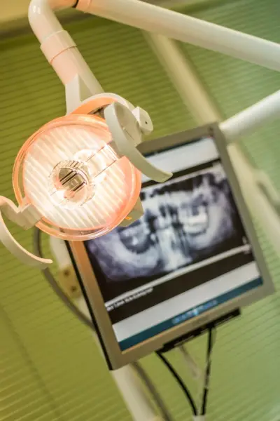 Имплантологичен кабинет BalevDental - Балев Дентал